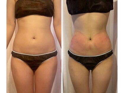 モテスリムの写真