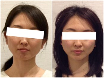 美容整体ウェリナ 名駅院/小顔矯正/骨盤矯正/美脚サロン