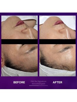 オスマンティエ(Osmantier)/バクチオールピール