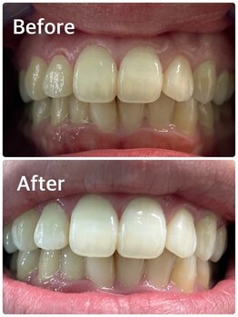 プラチナムビューティー 横須賀店/ビフォーアフター