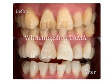 ホワイトニングショップ 多摩店/