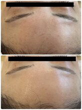 エイシスグロウ(asis glow.)/ララピール×水玉リフティング