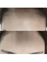 レッティー(retty)/retty