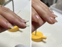 ネイルサロンスマイル(SMILE)/反り爪さんの before ＆ after