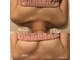 エニバストケア 草津の写真
