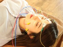 レゴリスの雰囲気（【電気美容鍼】たるみ・ほうれい線・左右差・リフトアップに◎）