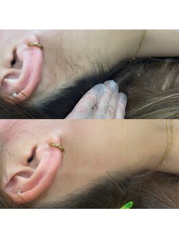 ニクス 札幌(NIX)/隠れた人気メニュー♪うなじWAX