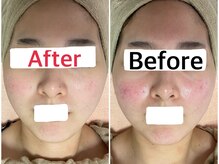 結果重視の様々なメニューをご用意★お悩みお聞かせください。