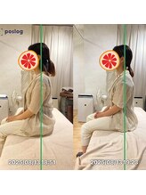 グレフル鍼灸接骨院 整体院 心斎橋/整体/肩こり/マッサージ/腰痛