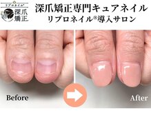 キュアネイル(Qa Nail)