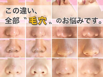 ロエヴェ(ROEWE)の写真