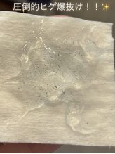 メロウ(mellow)/メンズヒゲ脱毛の効果☆