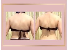 小顔美肌コルギ専門店 センティード 吉祥寺(Sentido)/肩甲骨くっきりで背中美人♪