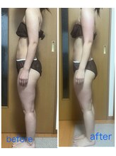 スーコ(SU:CO)/セル撃退！PR.CELL 施術一回