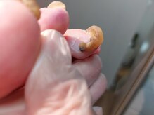 爪切り屋 足楽/前に一回転の爪