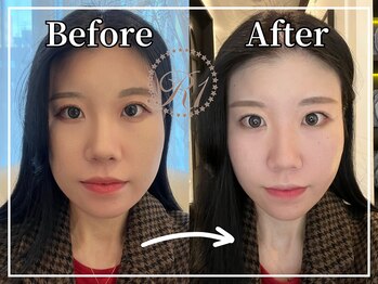 R-1ビューティーサロン 銀座/BEFORE＆AFTER 