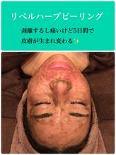 メイクアップスタジオ ウィッシュ(Make up Studio Wish!)/リベルハーブピーリング