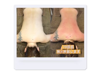 ドクタースタイル(Dr.style)/ビフォー＆アフター