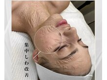 シルグラン(SIL gran)の雰囲気(世界で大流行中、NOTOXフェイシャル ゾンビマスク★)