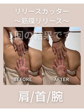 エン(enn.)/肩こり首凝り痛みにおすすめ