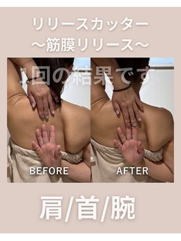 エン(enn.)/肩こり首凝り痛みにおすすめ