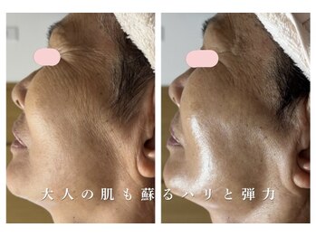 サロン ド ブラン(Salon de Blanc)の写真/たるみ、シワは"顔や年齢だけの問題"ではありません。