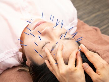 共立総合整骨院 町田鶴川院/肌質改善◎美容鍼コース