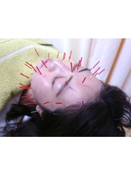 小顔になりたい