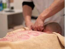 プラチナサロン 六本木の雰囲気（【首肩コリ＆腰痛】鍼灸&整体60分初回¥4,980【吸玉無料付】）
