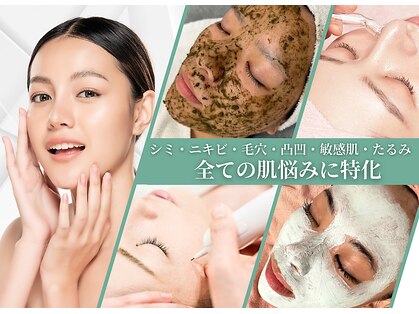 ベストベル(BestBelle)の写真