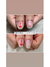シャンス(chance)/美爪育成ジェルネイル