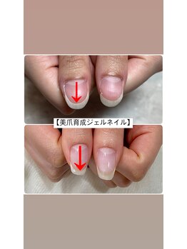 美爪育成ジェルネイル