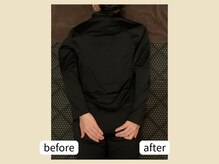 ミリュー(mylieu)/深部リンパ流しで驚きの左右差