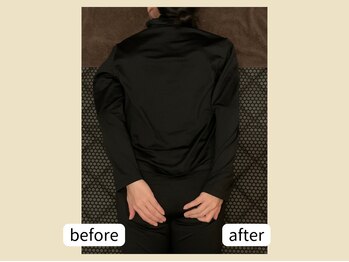 ミリュー(mylieu)/深部リンパ流しで驚きの左右差