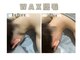 レヴィート(Revept)の写真