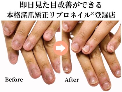 キュアネイル(Qa Nail)の写真