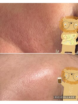 アンド リュクス(& Luxe)/臍帯100%が凄い