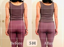 ロシュニ/40代 お悩み:たるみ/肋骨の厚み