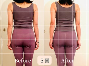 ロシュニ/40代 お悩み:たるみ/肋骨の厚み