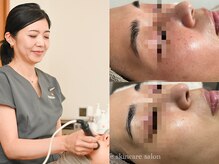 ナヴィータ アオバダイ(Navita AOBADAI)