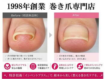 フットブルー横浜店の写真/【横浜駅5分】 創業1998年 痛い巻き爪専門店｜女性専用・有資格技術者が対応