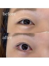 ビースタイル(B-style)/【マツパ】上下ラッシュリフト