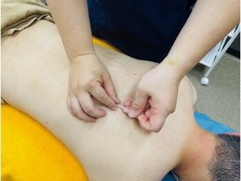 七里みんなの鍼灸整骨院/鍼でお身体の奥までアプローチ