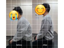 ナオル整体 西川口院(NAORU整体)/お客様のbefore/after　座位