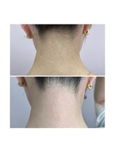 ホワイトワックス 京都四条烏丸(WHITE WAX)/《うなじ》スッキリ◎