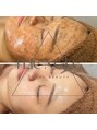 トリアングル(TLIENGLE)/total beauty TLIENGLE【肌質改善サロン】