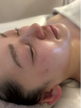リマインド(re mind)の写真/【腸美容サロンで肌質改善】何度も鏡を見たくなる肌へ。サロン迷子、スキンケア迷子から脱却した方多数◎