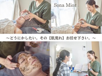 ソナミオール(SonaMior)