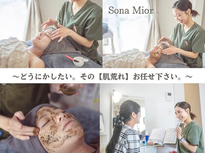 ソナミオール(SonaMior)の写真