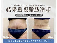 エアリアル 武雄店